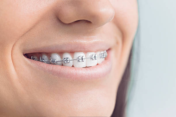 Best Traditional Braces  in Centerville, TN